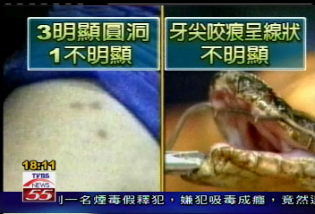 誰在搞軌／范氏傷口　專家：不像雨傘節咬痕