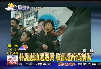 反對黨主席朴槿惠　助選遭襲臉傷