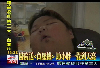 醫院送「負壓機」　助小胖一覺到天亮