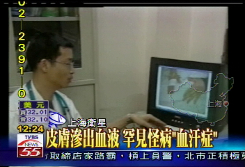 皮膚滲出血液　罕見怪病「血汗症」