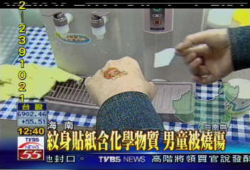 紋身貼紙含化學物質　男童被燒傷