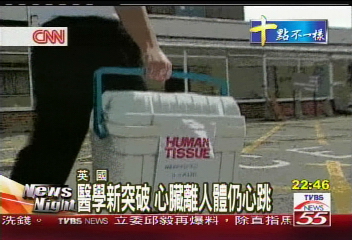 醫學新突破 心臟離人體仍心跳