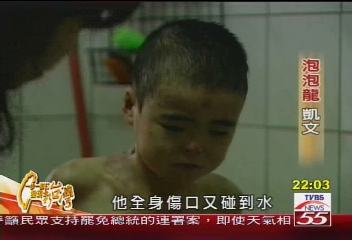 【一步一腳印】踏進人間嘗冷暖 「泡泡龍」身疼心更痛