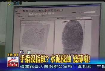 手指沒指紋? 水泥侵蝕變薄啦!