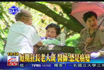 〈獨家〉背長老人斑 6旬老翁竟得胃腺癌