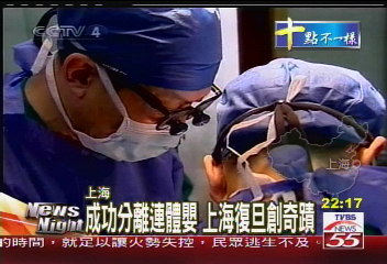 成功分離連體嬰 上海復旦創奇蹟