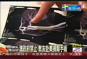 宗教團契引爭議　鼓吹教友捐腎