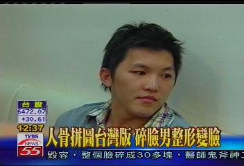 人骨拼圖台灣版　碎臉男整形變臉