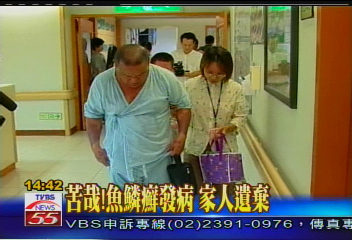 苦哉!魚鱗癬發病 家人遺棄