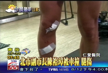 北市副市長陳裕璋車禍　腿擦傷