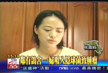 鄰有鴿舍 一婦吸入隱球菌致腫瘤
