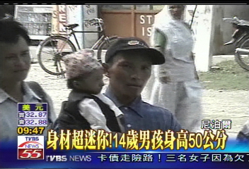 身材超迷你！　14歲男孩身高50公分