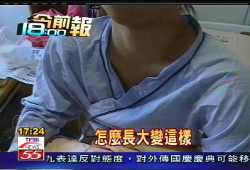 飆仔惡少逞兇　交大生險被砍斷手