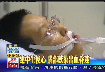 〈獨家〉建中生換心 腦部感染出血昏迷