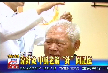 靠針灸　中風老翁「針」回記憶