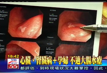 〈獨家〉遊走法律！　DIY水療機直銷會直擊