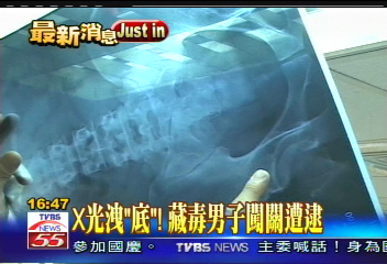 X光洩「底」! 藏毒闖關男子遭逮