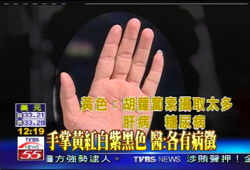 健康警訊! 手腳變黃:肝病