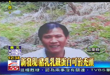 新發現！　豬乳乳鐵蛋白可治禿頭