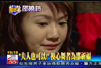 〈獨家〉一樣靠「體外維生」 女舞者重獲新生