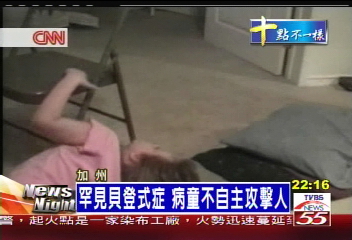 罕見貝登式症 病童不自主攻擊人