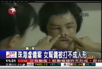 珠海虐傭案　女幫傭被打不成人形