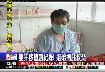 雙肝移植創紀錄！　姐弟捐肝救父