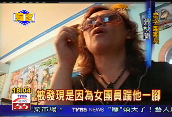 〈獨家〉制止性侵反遭毆 張秋蘭秀驗傷單