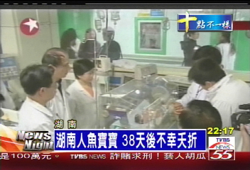 湖南人魚寶寶 38天後不幸夭折