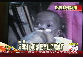 全國最小的早產兒 出生僅420克