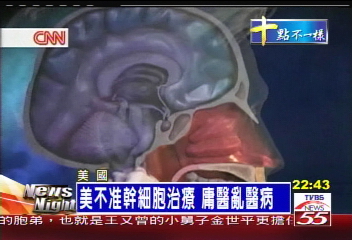 美不准幹細胞治療 庸醫亂醫病