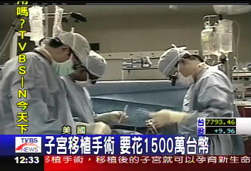 移植子宮 變性人可能有機會自孕
