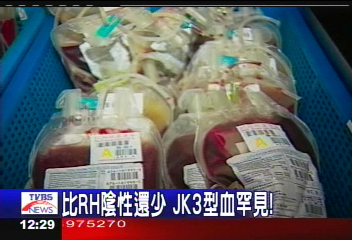 比RH陰性還少 JK3型血罕見!
