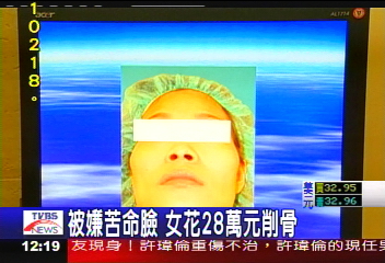 被嫌苦命臉 女花28萬元削骨