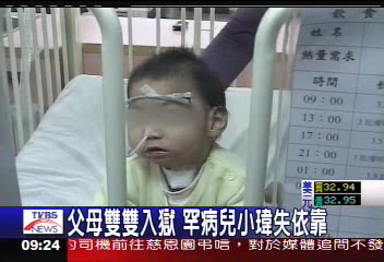 父母雙雙入獄 罕病兒小瑋失依靠