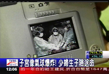 子宮像氣球爆炸！　少婦生子險送命