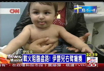 戰火阻臨盆路! 伊嬰兒右臂癱瘓