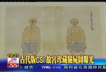 古代版CSI 故宮珍藏驗屍圖曝光