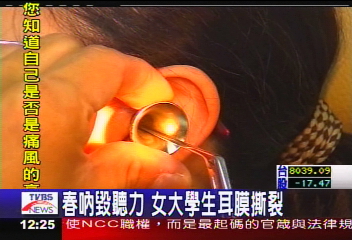 春吶毀聽力 女大學生耳膜撕裂