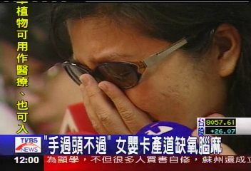 「手過頭不過」　女嬰卡產道缺氧腦麻