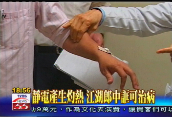靜電產生灼熱 江湖郎中誆可治病