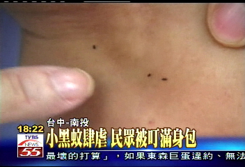 小黑蚊肆虐　民眾被叮滿身包