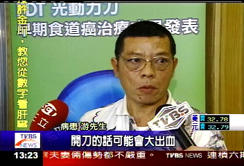 光動力治療新法 食道癌免開刀