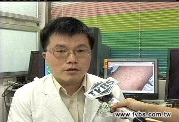 「超級細菌」發威　12歲童腳扭傷送命