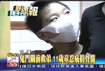 鬼門關前救弟　11歲童忍痛捐骨髓