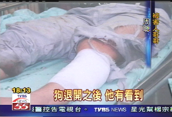 狗抓狂！　咬掉捷運工左小腿一口肉