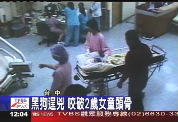 黑狗逞兇　咬破2歲女童頭骨