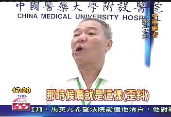 妙用肉毒桿菌 中風患手口正常運作