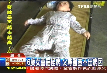 6歲女童罹怪病 父尋醫查不出病因