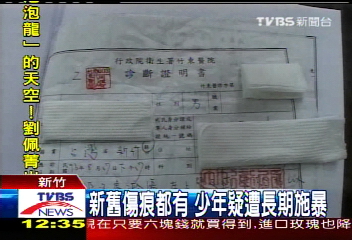 叔拿鐵條打親姪?15歲少年渾身傷